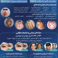 افتتاح لاین تخصصی زخم و استومی و مراقبت از پوست درمینو
