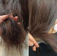 موخوره گیری به روش روسی وتضمینی