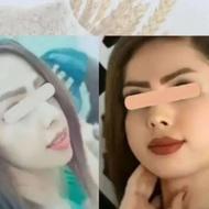پودر تپلی صورت شما