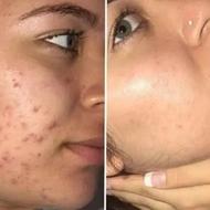 جدید ترین بیوممتیک سریع و دائمب جایگزین روش های پر هزینه