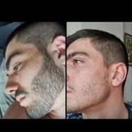 ته ریش فوق العاده