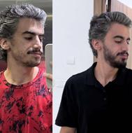 رویش ریش گیاهی