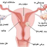 پاکسازی کامل ودائمی رحم و تخمدان