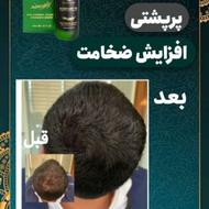 رویش مجدد.