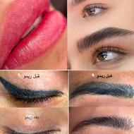 پاک کردن تتو های ابرو چشم لب تضمینی
