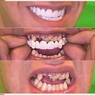 لمینت متحرک سواسمایل اورجینال+خمیر اضافه رایگان
