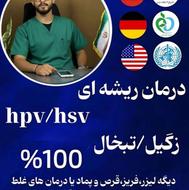 زگیل تناسلی درمان شد