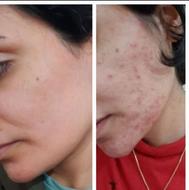 اصلاح صورت همراه با پاکسازی صورت فقط ...