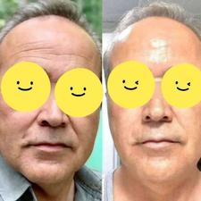 کرم لیفت ماساژوری