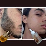 رویش ریش و مو تو 25 روز