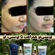 لک،تیرگی،جوش