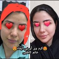 کرم وی آی پی معجزه اصل(آموزش ساخت کرم)