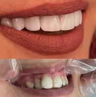 تخفیفات عیدانه دندانپزشکی (با بیش از 14سال سابقه)
