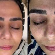 شما فقط نمونه کار هارو ببینید بقیش با من