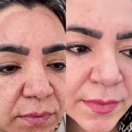 پماد بیومیمتیک اورجینال شارژ شد