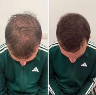 با آینه آشتی کن (به صورت گیاهی)