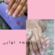 مدل ناخن رایگان فقط هزینه مواد گرفته میشه