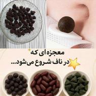 آموزش رایگان قرص ناف معجزه
