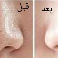 پاکسازی جوانسازی پوست صورت همراه با دست