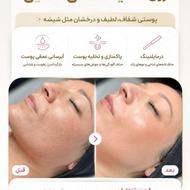 تخفیف ویژه یک میلیون تومانی روی تکنیک گلساسکین