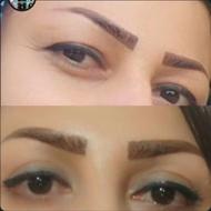 عمل پلک و (انواع جراحی چشم)