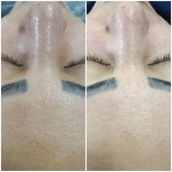 فشیال تخصصی،طب سنتی،ژل وبوتاکس،لیزر پرسینگ میکرودرمال