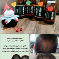 درمان ریزش مو و رویش مجدد