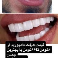 کامپوزیت و دندان مصنوعی پرکردن. روکش