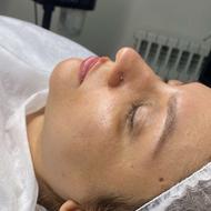 مدل فیشال و پاکسازی پوست