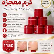کرم معجزه شب