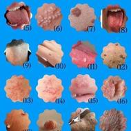 موهات قهر کرده؟ | مشاوره ریزش موی سکهای و HPV