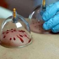 حجامت ،،بادکشی،،ماساژ ریلکسی