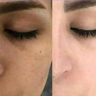 پوستی روشن و شفاف داشته باش
