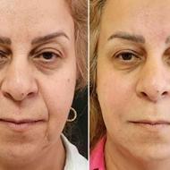 غول جوانساز بیوممتیک