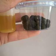 چربی سوزناف