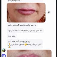 ریموو تاتو