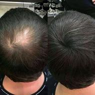 افزایش شادابی مو