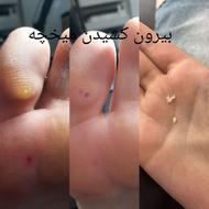 خدمات اپیلاسیون و پدیکور شمع و ابرو تخصصی بانوان