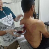 ماساژ حجامت زالو فصد بادکش دررفتگی دیسک سیاتیک طب سوزنی ناف