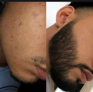 این اقدام اخریشه