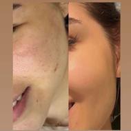 کرم بیو ممتیک زده چین و چروک صورتت