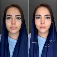 جشنواره کلینیک زیبایی هایفو و بوتاکس و فیلر