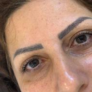لیفت مژه و ابرو