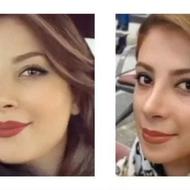 چاقی صورت تضمینی /تقویت ناخن