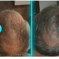 شامپو مورینگا اکسونیک