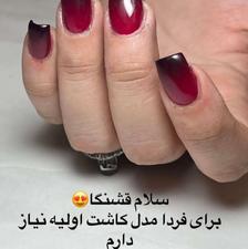 کاشت و ترمیم رایگان ناخون