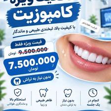 تخفیف کامپوزیت دندان