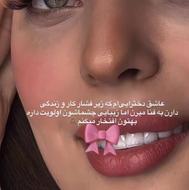 مژه هاتو خوشگل کن