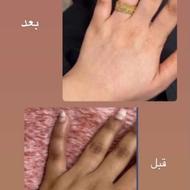 فرمول سفید برفی